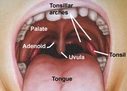tonsil stones & bad breath cures